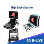 4D-ultrasound-machine-768×768