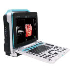 P50-ultrasound-machine
