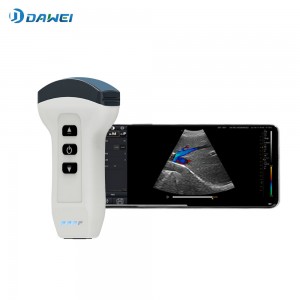 Wireless Handheld Ultrasound